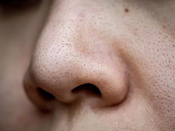 how to get rid of large pores for men